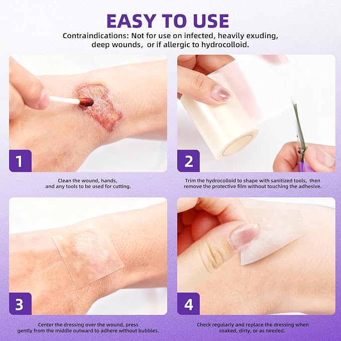 Hydrocolloid Bandages for Wound Care, Hydrocolloid Roll with Self-Adhesive,Ultra Absorbent, Flexible & Waterproof, DIY Size & Shape First Aid Kit Essential (2in*5ft)