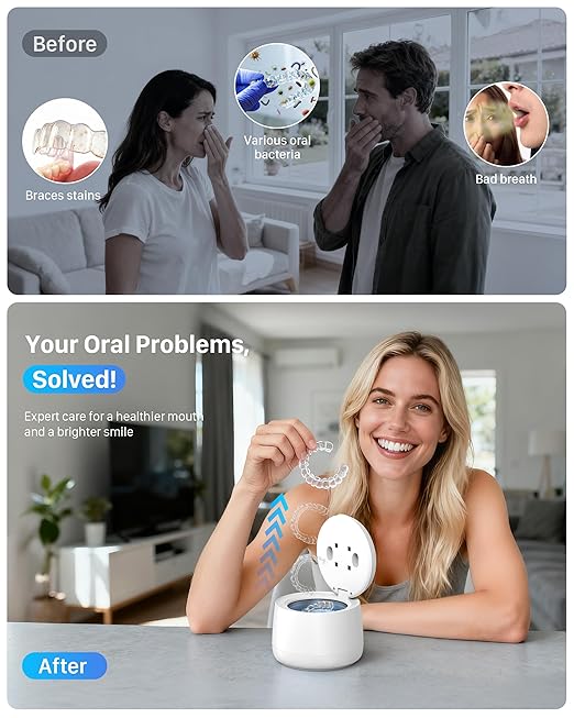 Ultrasonic Retainer Cleaner Machine: Dental Cleaning Pod for Dentures, Mouth Guards, Aligners, Night Guards, Braces, Toothbrush Heads & Jewelry, 45kHz Retainer Cleaner with 4 Modes & 200ML Capacity