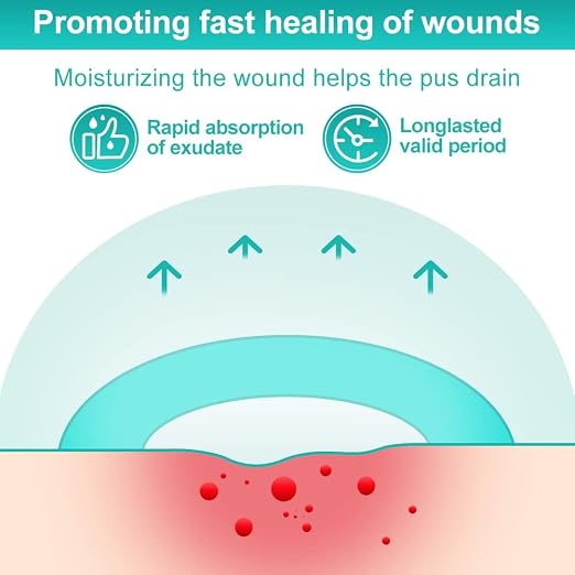 Dimora Hydrocolloid Dressing 4" x 4" for Wound Care, 10 Pcs Large Patch Bandages with Self-Adhesive for Bedsore, Burn, Blister, Acne Care, Super Absorbent for Fast Healing