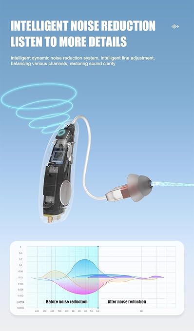 B501 Professional Hearing Aids for Severe Hearing Loss Seniors- 45dB Gain & 16-Channel Precision, Anti-Whistling Tech, 50H Battery with Charging Case, Self-Fitting Discreet Design