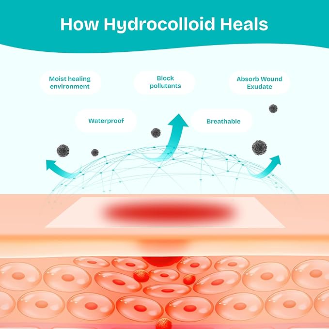 Hydrocolloid Wound Care Roll, Waterproof 2in x 16.5ft, Extra Large Cut-to-Size Self-Adhesive Bandages for Blister, Scar, Pimple, First Aid Essential