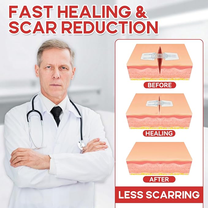3 PCS Wound Closure Strips for Emergency Laceration & Wound Repair - Zipstitch Sutures - Painless Alternative to Stitches - Butterfly Bandages for Hiking, Camping, Survival & First Aid Kit Essential