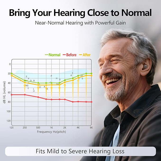 Edifier Bluetooth OTC Hearing Aids for Seniors, APP Control, Bluetooth In the ear Hearing Aids, Nearly Invisible Hearing Aid, Rechargable Comfort Design Wireless Music Phone Call (Brown) (H Brush)