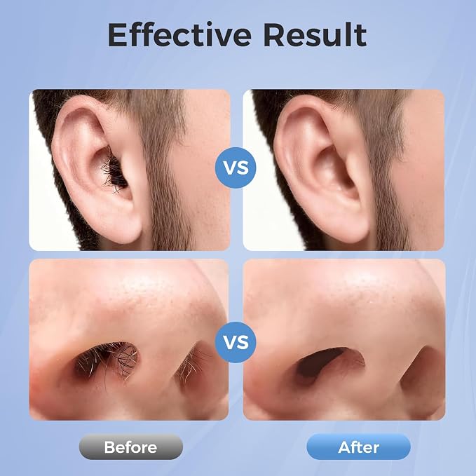 Nose Wax Kit Men: Nose and Ear Hair Removal Kit with Smart Temperature Control & USB C Fast Heating, Nose Hair Wax Kit Includes 100g Hard Wax Beans 20 Sticks & Travel Bag | Lasts up to 7 Weeks 15 Uses