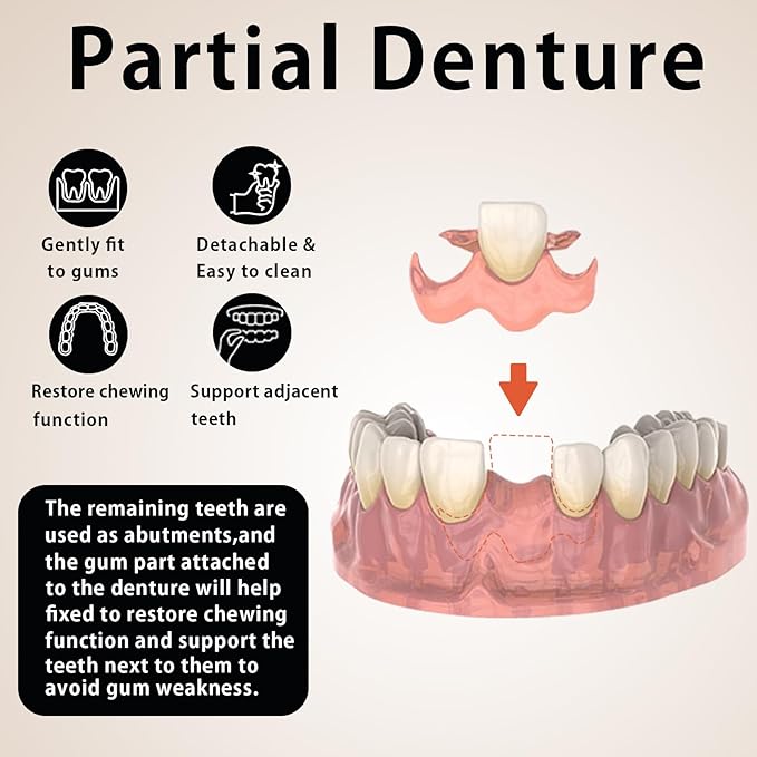 Custom Partial Dentures for Women with No Teeth, Temporary Dentures for Men, Removable Dentures for Tooth, Personalized Replacement Teeth, Adjustable & Comfortable, Easy to Use (1 Tooth)