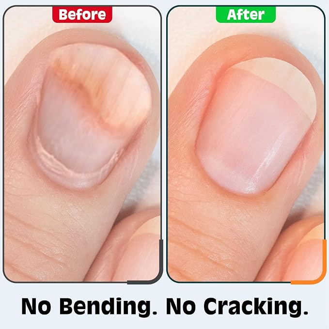 Nail Clippers Set, Fingernail and Toenail Clipper Cutters Kit | Ultra Sharp All-IN-ONE Kit: 15% Thicker Premium Sturdy Podiatrist Toe Nail Care Tools. Perfect Grooming Gifts with Case