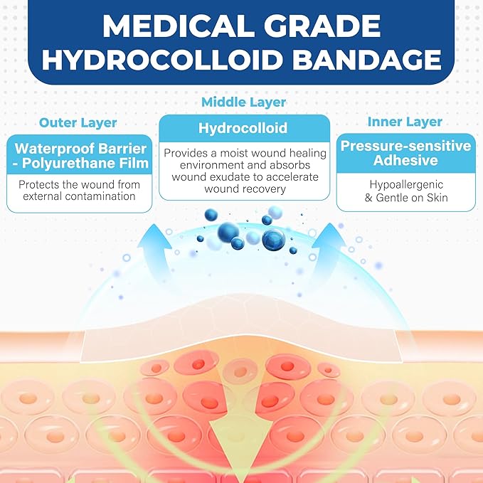 Hydrocolloid Roll, 2in x 12ft, 3 Rolls, Waterproof Hydrocolloid Bandages for Acne, Pimple, Burns, Blisters, Scrapes, Minor Cuts, Wound Care, Medical Adhesive Colloidal Dressing Patch