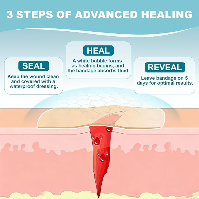 Dodanros Advanced Fast Healing Large Hydrocolloid Gel Bandages, Adhesive Wound Care Pads, 3.07 * 2.32 in （15 Count）