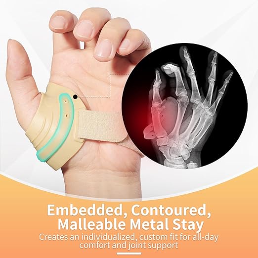 AKSO MEDICOS CMC Thumb Brace - Comfortable Thumb Splint for CMC Joint Pain, Osteoarthritis, Tendonitis, Arthritis, CMC Joint Thumb Arthritis Brace for Women & Men (Left Hand, Large, Beige)