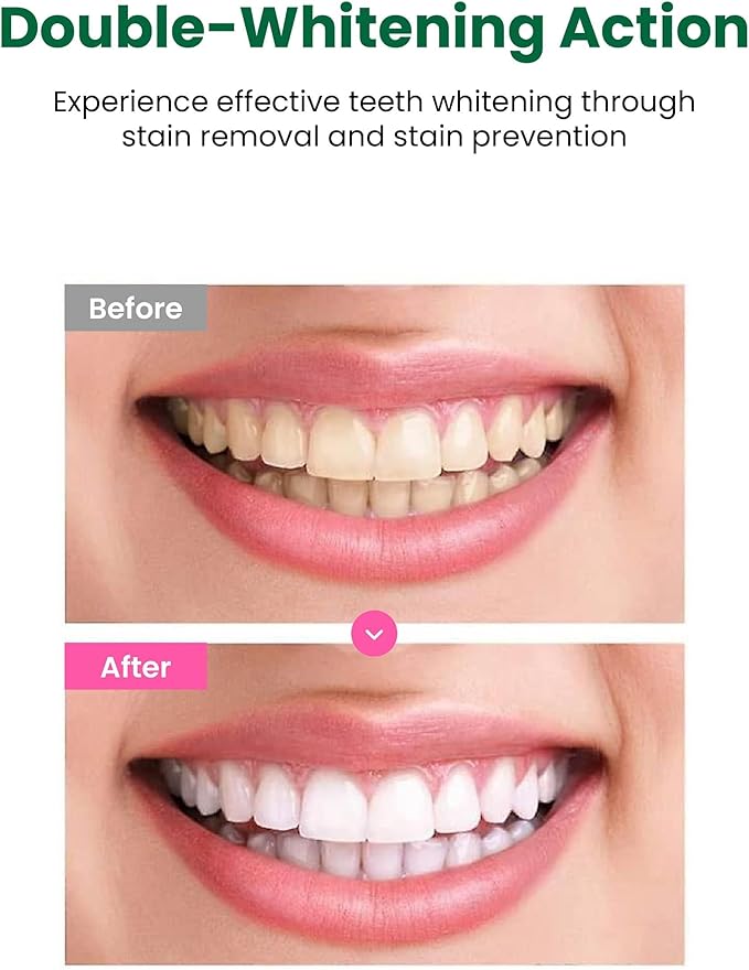 EUTHYMOL Whitening Toothpaste (3.7fl oz) - Stain Removal in 2 Weeks, Long-Lasting Freshness for Sensitive Gum & Teeth. Bad Breath, Cavity Prevention. Recyclable Aluminum Tube