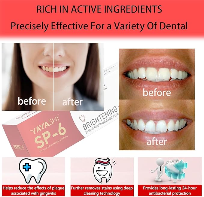 2-Pack SP-6 Probiotic Whitening Toothpaste - Enhanced Formula with 6 Probiotics for Teeth Whitening and Gum Health - Enamel-Safe, Fluoride-Free, Double Mint Flavor,Fresh Breath (Double Mint)