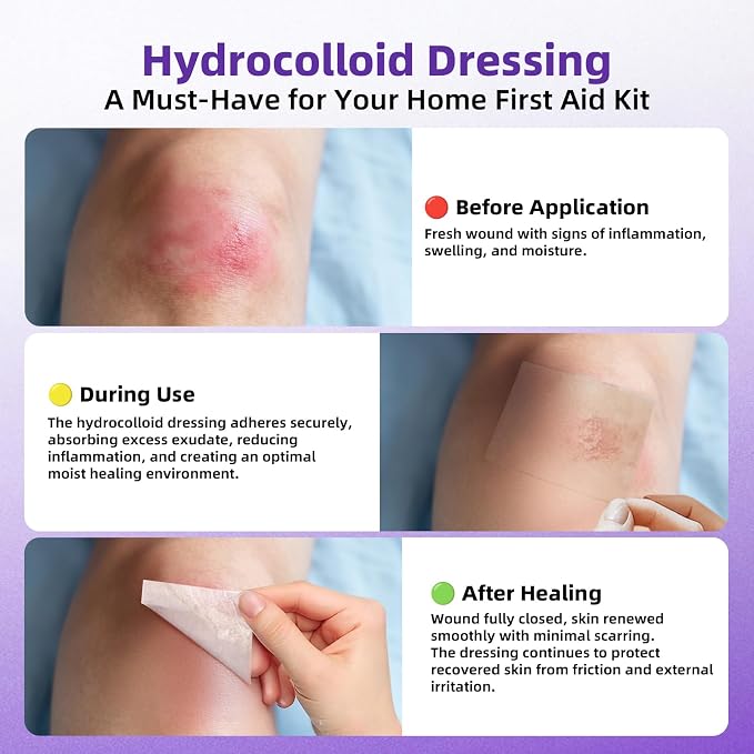 Hydrocolloid Bandages for Wound Care, Hydrocolloid Roll with Self-Adhesive,Ultra Absorbent, Flexible & Waterproof, DIY Size & Shape First Aid Kit Essential (2in*5ft)