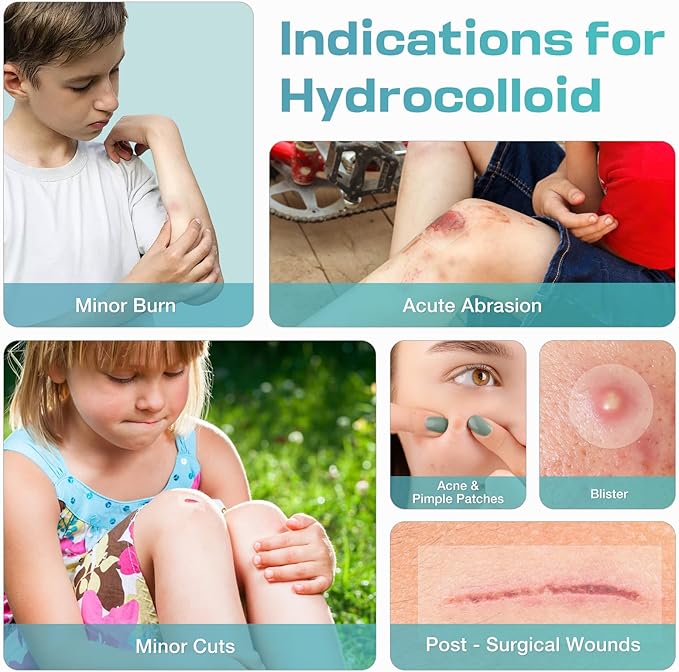 Hydrocolloid Roll for Wound Care, Medical-Grade Hydrocolloid Patch Bandages with Self-Adhesive, Cut-to-Size Ultra Absorbent, Flexible & Waterproof, First Aid Kit Essential (2in*16ft)