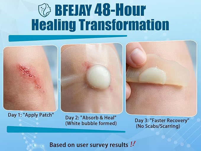 Hydrocolloid Bandages for Wound Care, Medical-Grade Hydrocolloid Roll with Self-Adhesive, Ultra Absorbent, Flexible & Waterproof, Cut-to-Size First Aid Kit Essential (2in*12ft)