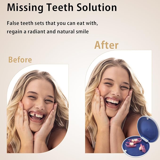 Custom Partial Dentures for Women with No Teeth, Easy to Use, Temporary Dentures for Men, Removable Dentures for Tooth, Adjustable & Comfortable, Personalized Replacement Teeth (5 Teeth)
