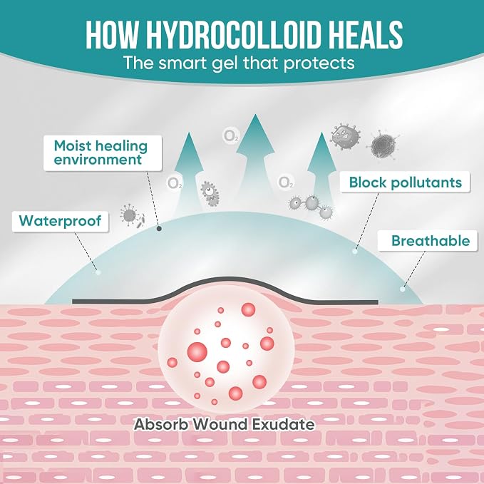 Hydrocolloid Roll for Wound Care, Hydrocolloid Patch Bandages with Self-Adhesive, Bed Sore Bandages, Highly Absorbent for Burn, Blister, Acne Care, Waterproof (3in x 8ft)