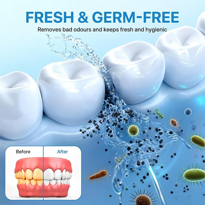 Ultrasonic Retainer Cleaner with UV-C, 45kHz Rechargeable Dental Cleaning Machine 4000mAh, 200ML for Denture, Mouth Guard, Night Guard, Aligner, 3 Modes & 6 Cleaning Tablets