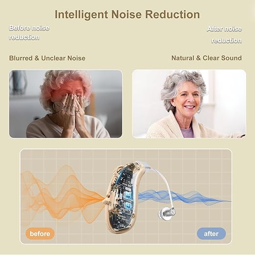 Rechargeable Hearing Aids for Seniors - Noise-Canceling Behind-the-Ear Amplifiers with Stepless Volume Control, Lightweight & Comfortable for Daily Use