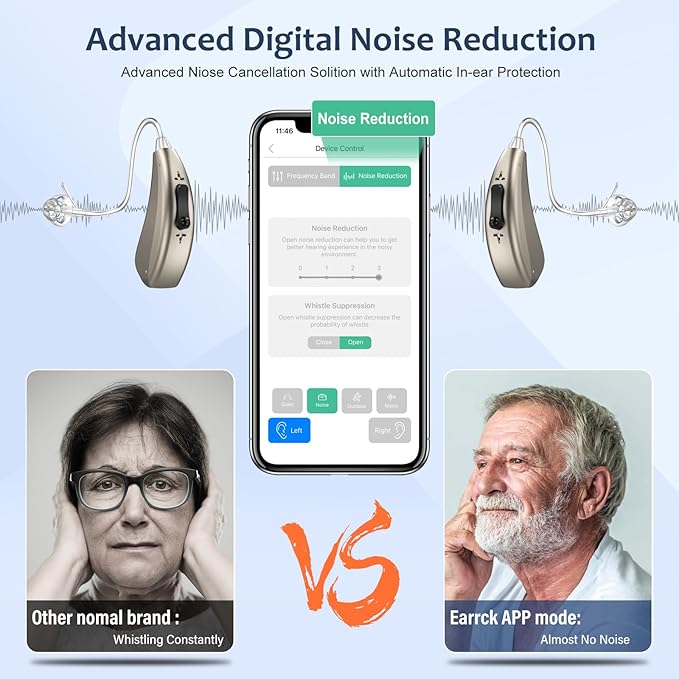 Hearing Aids for Seniors with Noise Cancelling, Rechargeable Hearing Amplifier with with Smart APP Control for People with Hearing Loss（Beige）