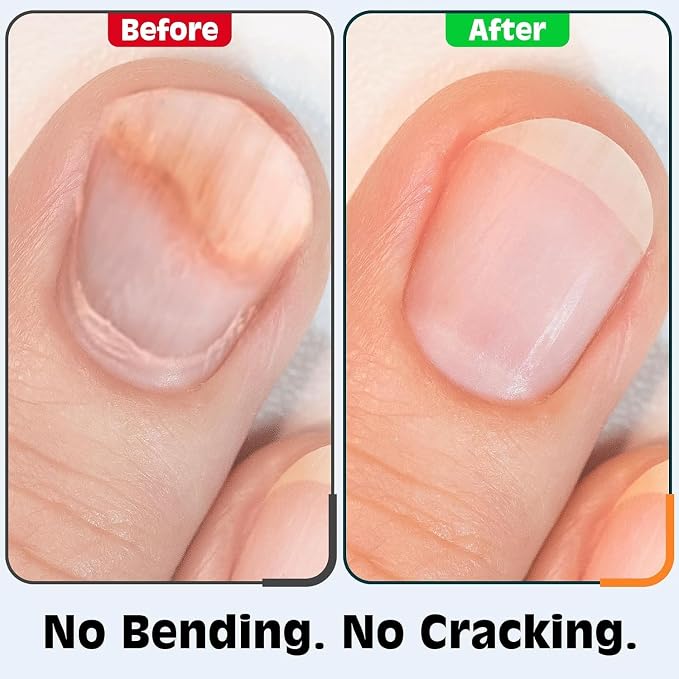 Nail Clippers Set, Fingernail and Toenail Clipper Cutters Kit | Ultra Sharp All-IN-ONE Kit: 15% Thicker Premium Sturdy Podiatrist Toe Nail Care Tools. Perfect Grooming Gifts with Case