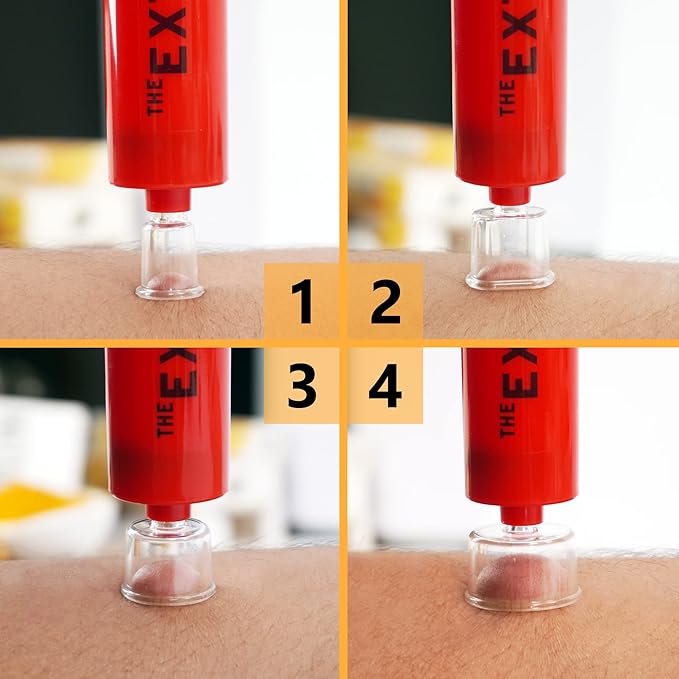 Snake Bite Kit for Humans, Bee Sting Kit, Rattlesnake Antivenom Extractor Sucker, Bug Bite and Wasp Sting, Poison Remover, Insect Bite Relief First Aid Kit for Hiking, Backpacking, Camping