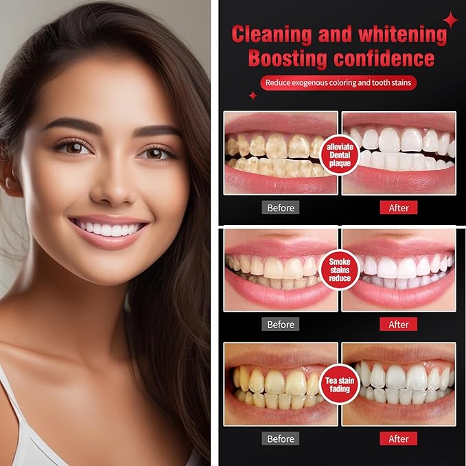 Sp-6 Super Probiotic Brightening Toothpaste, 6 Probiotics Formula for Gum Health,Strengthening Microbiota Oral Microbiota Strength for, Fluoride-Free, Fresh Mint Flavor, 4.9 OZ (Natural Mint-1PCS)