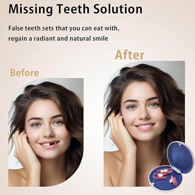 Custom Partial Dentures for Women with No Teeth, Temporary Dentures for Men, Removable Dentures for Tooth, Personalized Replacement Teeth, Adjustable & Comfortable, Easy to Use (2 Teeth)