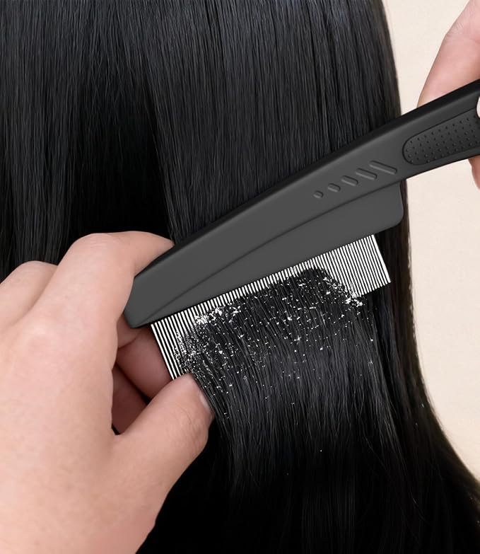 Dandruff Comb Removal 2PC Hollow Fine Tooth Scalp Detox Hair Care Tool | Upgraded Stainless Steel Teeth, with Gift Box, Build up Flake, Self Cleaning, Button-Release Design, for Women Men Kid, Green