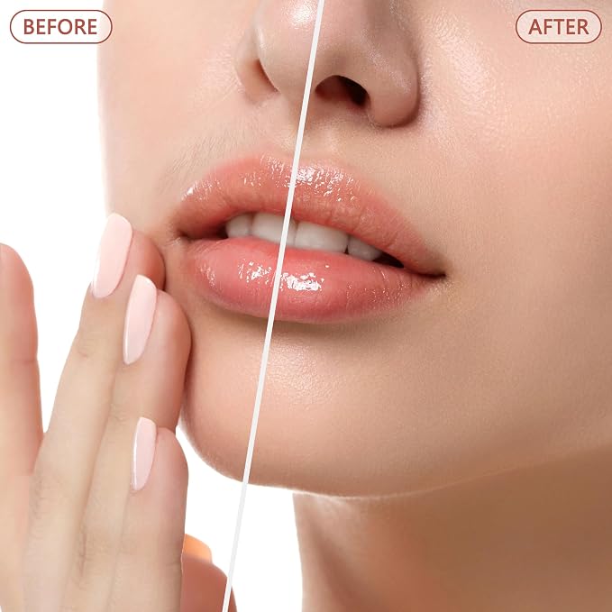 Facial Hair Remover for Women - as Seen on TV Painless Face Shaver - Electric Hair Removal Device for Face Lips Peach Fuzz with Light (Blue)