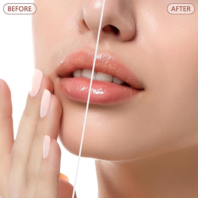 Facial Hair Remover for Women - as Seen on TV Painless Face Shaver - Electric Hair Removal Device for Face Lips Peach Fuzz with Light (Rose Gold)