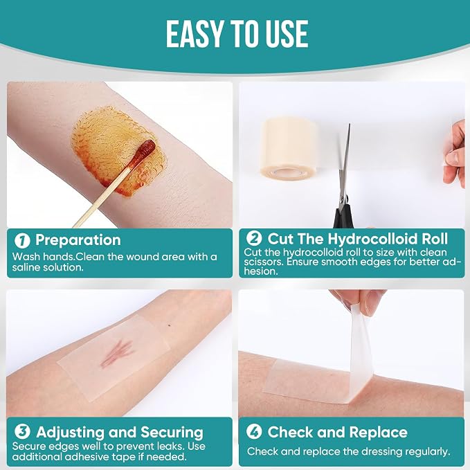 Hydrocolloid Roll for Wound Care, Hydrocolloid Patch Bandages with Self-Adhesive, Bed Sore Bandages, Highly Absorbent & Waterproof for Burn, Blister, Acne Care, First Aid Kit Essential (2in x 12ft)