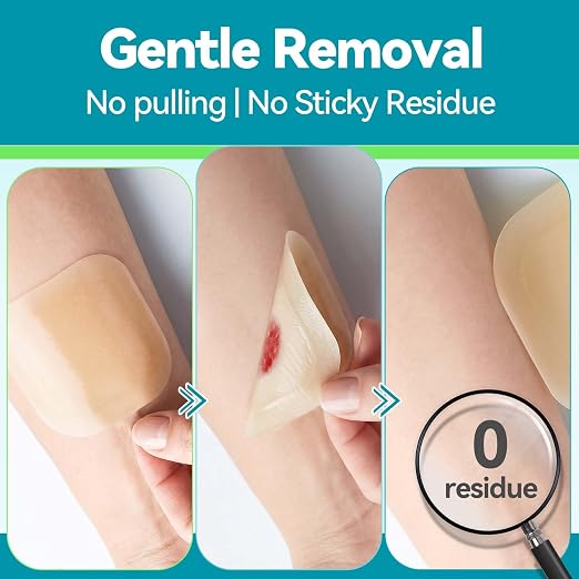 Dimora 4" x 4" Hydrocolloid Dressing Tapered Edges for Wound Care, 10 Pcs Large Hydrocolloid Bandages for Burn, Blister, First Aid Kit Essential Wound Dressing