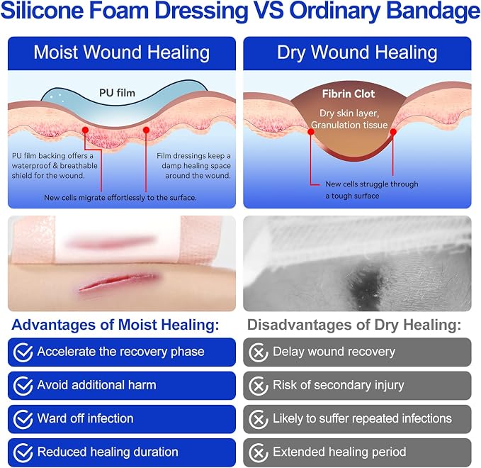 Silicone Foam Dressing 4"x4"(10 PCS), Waterproof Silicone Large Bandages for Wound with Border Adhesive, High Absorbency Bed Sore Bandages Wound Care Dressing (2.5"X2.5" Pad)