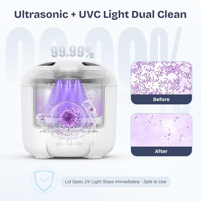 2025 Ultrasonic Retainer Cleaner- 45KHz 25W Portable Denture Cleaner with Drying Function and Removable Inner for Dentures, Mouth Guards, Aligners, Jewelry and More
