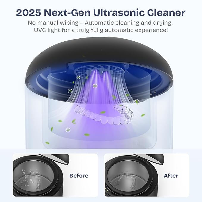 2025 Ultrasonic Retainer Cleaner- 45KHz 25W Portable Denture Cleaner with Drying Function and Removable Inner for Dentures, Mouth Guards, Aligners, Jewelry and More (Black)