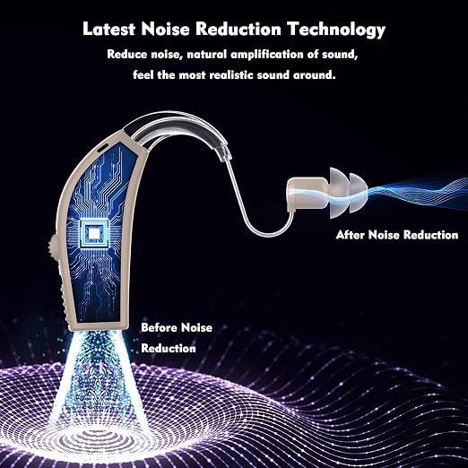 Hearing Aids, Rechargeable Hearing Aids for Seniors, Hearing Amplifiers with Noise Cancelling & Volume Control-Hearing Aid Loss Amplifier Seniors & Adults Charging Case-Beige