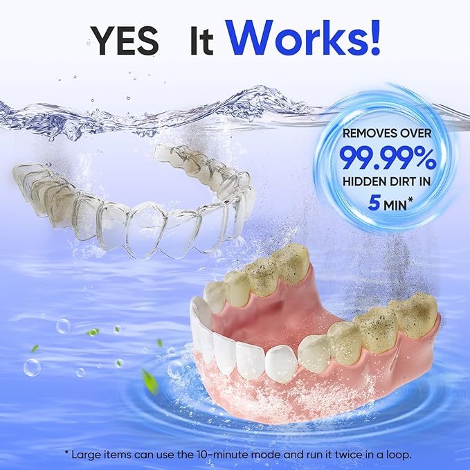 MySmile Dental Ultrasonic Retainer Cleaner Machine- 45kHz UV Denture Cleaner with 200ML Capacity for Aligner, Braces, Mouth Guard, Night Guard, Portable Dental Cleaning Pod with Digital Timer (Black)