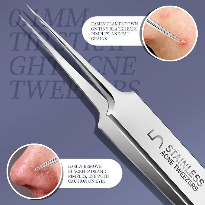 Teenitor 7 Pcs Pimple Popper Tool Kit, Surgical Grade Blackhead Remover Tools, Ingrown Hair Tweezers, Blackhead Extractor Pimple Extractor, Black Head Remover