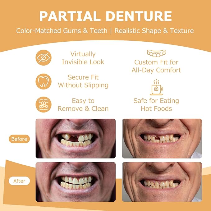 Partial Dentures - Dentures for Missing Teeth & Gaps - Lightweight & Unbreakable Replacement Teeth for Men & Women (1 Tooth)