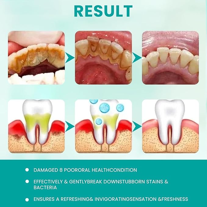 2pcs Sp6 Probiotic Whitening Toothpaste, Sp 6 Toothpaste, Sp-6 Ultra Whitening, Fresh Breath