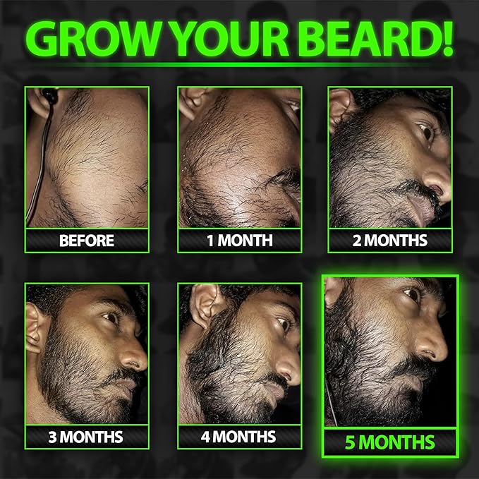 Beard Growth Kit w/GROW XXL Beard Oil/Serum for Facial Hair Growth for Men + 100% Lifetime Replacement First Cut Boar Bristle Brush & 360 Wave Brush for Men - Formulated in America