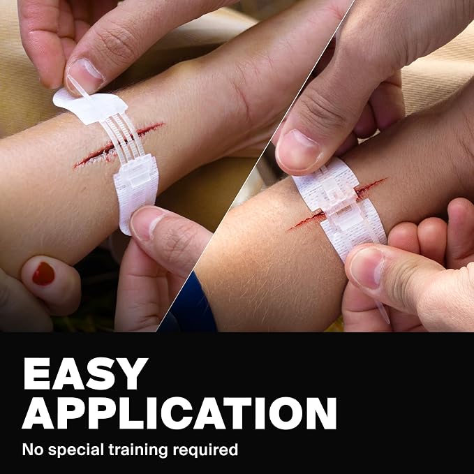 SurviveX Zip Stitch Wound Closure Strips - Repair Wounds Without Stitches - Zipstitch Sutures - Laceration Closure First Aid Kit