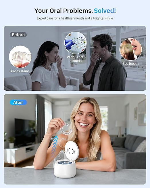 Ultrasonic Retainer Cleaner Machine: Dental Cleaning Pod for Dentures, Mouth Guards, Aligners, Night Guards, Braces, Toothbrush Heads & Jewelry, 45kHz Retainer Cleaner with 4 Modes & 200ML Capacity