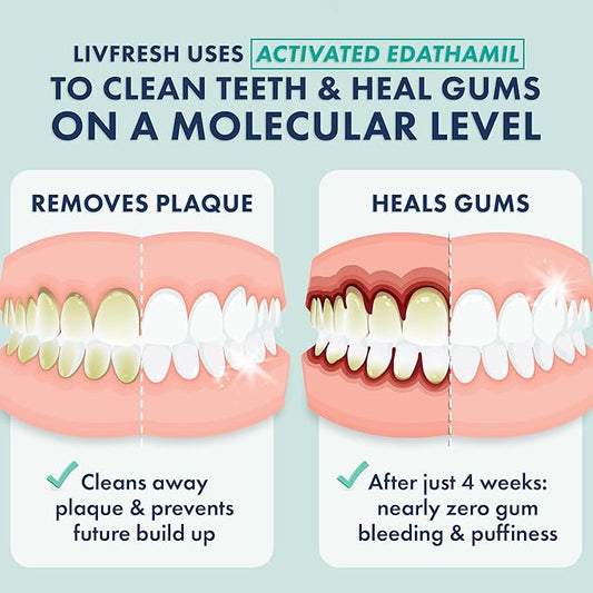 LIVFRESH Toothpaste Gel, Clinically Proven to Remove Plaque 250% Better, Improves Gum Health 190% Better, Prevents & Reduces Tartar, Freshens Breath, SLS Free Dental Gel, Wintergreen