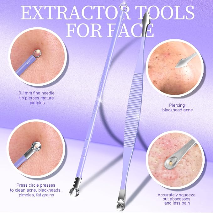 Teenitor Pimple Popper Tool Kit and Blackhead Remover Tools, Ingrown Hair Tweezers, Professional Blackhead Extractor Pimple Extractor Comedone Extractor